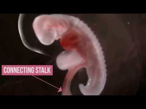 EMBRYO = LEECH AMAZING QURAN MIRACLE #MINDBLOW